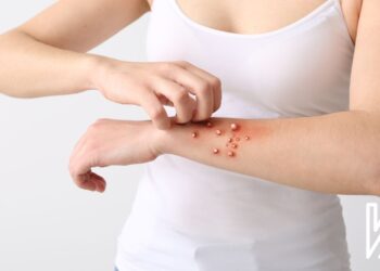 Nexweşîyên Zoonozî