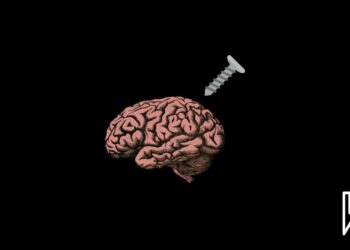 Baştirîn Împlanta Mejî Hate Çêkirin