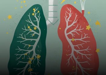 Gav bi Gav Devjêberdana Çixareyê!